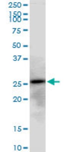 AK3, Mouse anti-Human, Polyclonal Antibody, Abnova 50&mu;g; Unconjugated:Antibodies,