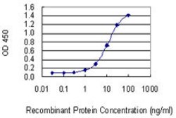 TBX22, Mouse anti-Human, Clone: 1A10, Abnova 100 &mu;g | Buy Online | Abnova | Fisher Scientific