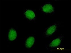 EXOSC1, Mouse anti-Human, Polyclonal Antibody, Abnova 50&mu;g; Unconjugated:Antibodies,