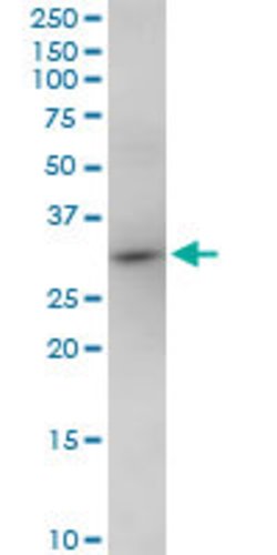 NOSIP, Mouse anti-Human, Polyclonal Antibody, Abnova 50 &mu;g | Buy Online | Abnova | Fisher Scientific