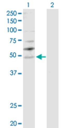 YBX2, Rabbit anti-Human, Polyclonal Antibody, Abnova 100&mu;g; Unconjugated:Antibodies,
