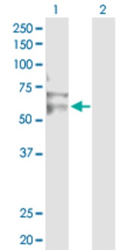 RNF12, Rabbit anti-Human, Polyclonal Antibody, Abnova 100 &mu;g | Buy Online | Abnova | Fisher Scientific