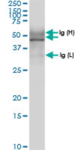 TUBD1, Rabbit anti-Human, Polyclonal Antibody, Abnova 100 &mu;L | Buy Online | Abnova | Fisher Scientific