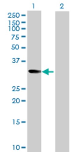 NT5C3, Mouse anti-Human, Polyclonal Antibody, Abnova 50 &mu;g | Buy Online | Abnova | Fisher Scientific