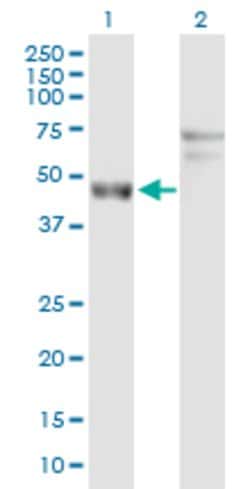 ARL6IP4, Rabbit anti-Human, Polyclonal Antibody, Abnova 100&mu;g; Unconjugated:Antibodies,