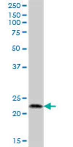 C2orf28, Mouse anti-Human, Polyclonal Antibody, Abnova 50 &mu;g | Buy Online | Abnova | Fisher Scientific