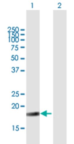 NIP7, Mouse anti-Human, Polyclonal Antibody, Abnova 50&mu;g; Unconjugated:Antibodies,