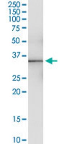 PRRX2, Rabbit anti-Human, Polyclonal Antibody, Abnova 100 &mu;L | Buy Online | Abnova | Fisher Scientific