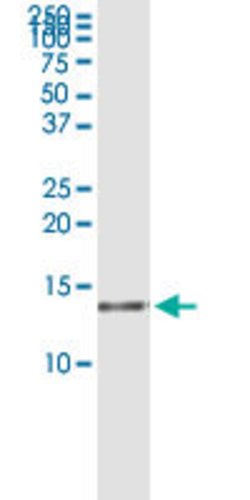 HSPC152, Rabbit anti-Human, Polyclonal Antibody, Abnova 100 &mu;L | Buy Online | Abnova | Fisher Scientific
