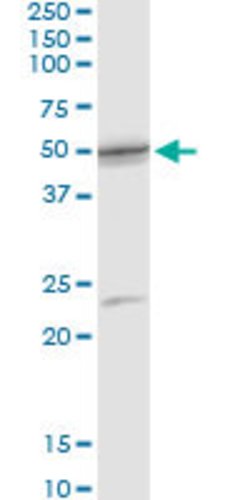 SCLY, Rabbit anti-Human, Polyclonal Antibody, Abnova 100&mu;L; Unconjugated:Antibodies,