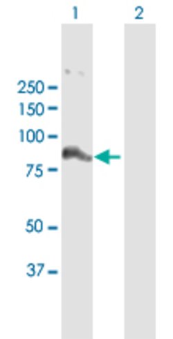 FBXO40, Rabbit anti-Human, Polyclonal Antibody, Abnova 100&mu;L; Unconjugated:Antibodies,