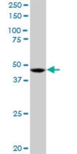 RP6-213H19.1, Mouse anti-Human, Polyclonal Antibody, Abnova 50 &mu;g | Buy Online | Abnova | Fisher Scientific