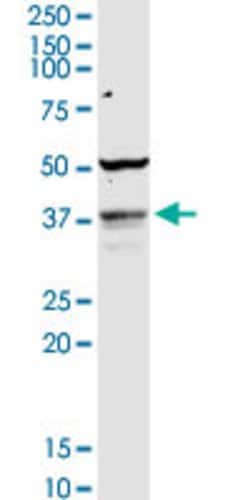 COQ3, Rabbit anti-Human, Polyclonal Antibody, Abnova 100&mu;g; Unconjugated:Antibodies,