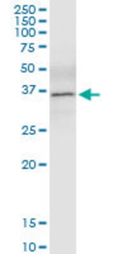 MBD3, Rabbit anti-Human, Polyclonal Antibody, Abnova 100&mu;L; Unconjugated:Antibodies,