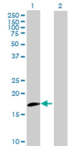 IL20RB, Mouse anti-Human, Polyclonal Antibody, Abnova 50&mu;g; Unconjugated:Antibodies,