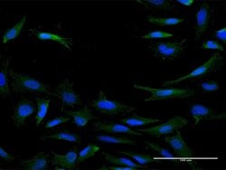 IL20RB, Mouse anti-Human, Polyclonal Antibody, Abnova 50&mu;g; Unconjugated:Antibodies,