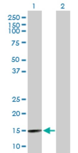 BRWD1, Mouse anti-Human, Polyclonal Antibody, Abnova 50&mu;g; Unconjugated:Antibodies,
