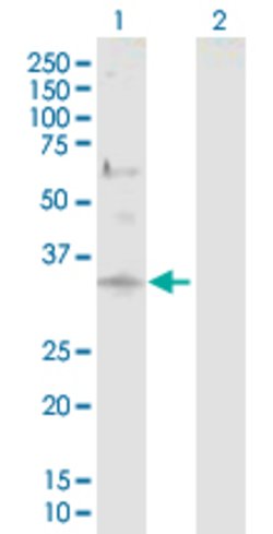 DCUN1D1, Rabbit anti-Human, Polyclonal Antibody, Abnova 100 &mu;g | Buy Online | Abnova | Fisher Scientific