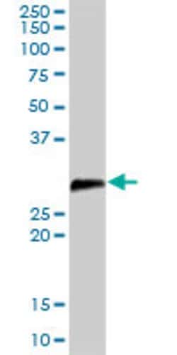 DCUN1D1, Rabbit anti-Human, Polyclonal Antibody, Abnova 100 &mu;g | Buy Online | Abnova | Fisher Scientific