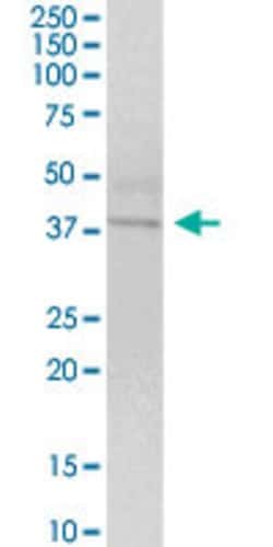 WNT4, Mouse anti-Human, Polyclonal Antibody, Abnova 50&mu;g; Unconjugated:Antibodies,