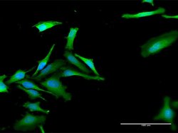 FBXO42, Rabbit anti-Human, Polyclonal Antibody, Abnova 100&mu;L; Unconjugated:Antibodies,