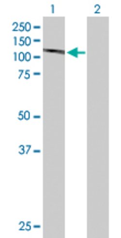 DGCR8, Rabbit anti-Human, Polyclonal Antibody, Abnova 100&mu;g; Unconjugated:Antibodies,
