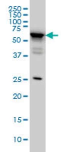 DDX56, Mouse anti-Human, Clone: 4C5, Abnova 100&mu;g; Unconjugated:Antibodies,