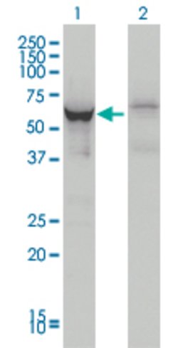DDX56, Mouse anti-Human, Clone: 4C5, Abnova 100&mu;g; Unconjugated:Antibodies,