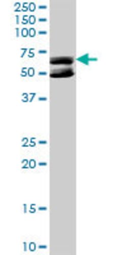KLHDC4, Rabbit anti-Human, Polyclonal Antibody, Abnova 100 &mu;g | Buy Online | Abnova | Fisher Scientific