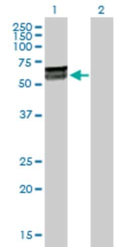 KLHDC4, Rabbit anti-Human, Polyclonal Antibody, Abnova 100 &mu;g | Buy Online | Abnova | Fisher Scientific