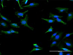 TRIT1, Mouse anti-Human, Polyclonal Antibody, Abnova 50&mu;g; Unconjugated:Antibodies,