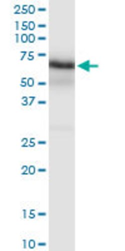 ERCC6L, Rabbit anti-Human, Polyclonal Antibody, Abnova 100&mu;L; Unconjugated:Antibodies,
