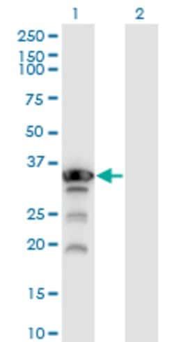 APTX, Mouse anti-Human, Clone: 2H6, Abnova 100&mu;g; Unconjugated:Antibodies,