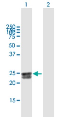 HEATR2, Mouse anti-Human, Polyclonal Antibody, Abnova 50&mu;g; Unconjugated:Antibodies,