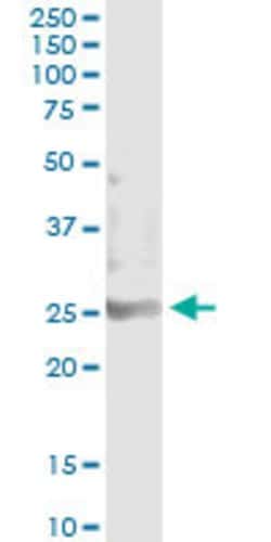 SOHLH2, Mouse anti-Human, Clone: 1E1, Abnova 100&mu;g; Unconjugated:Antibodies,