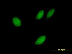 TXNL4B, Mouse anti-Human, Polyclonal Antibody, Abnova 50&mu;g; Unconjugated:Antibodies,