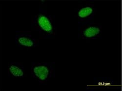 ARGLU1, Mouse anti-Human, Polyclonal Antibody, Abnova 50&mu;g; Unconjugated:Antibodies,