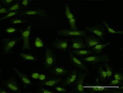 WDR79, Rabbit anti-Human, Polyclonal Antibody, Abnova 100 &mu;g | Buy Online | Abnova | Fisher Scientific