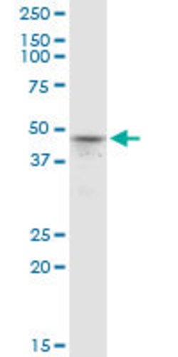 PRMT6, Mouse anti-Human, Clone: 3C3, Abnova 100&mu;g; Unconjugated:Antibodies,