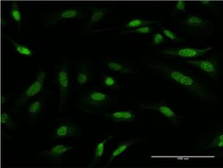 PRMT6, Mouse anti-Human, Clone: 3C3, Abnova 100&mu;g; Unconjugated:Antibodies,