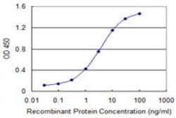 RCBTB1, Mouse anti-Human, Clone: 1E4, Abnova 100&mu;g; Unconjugated:Antibodies,