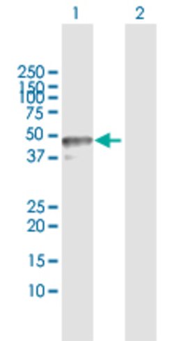 TRIM62, Rabbit anti-Human, Polyclonal Antibody, Abnova 100&mu;L; Unconjugated:Antibodies,