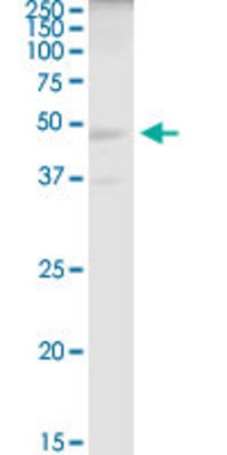 ELAC1, Mouse anti-Human, Polyclonal Antibody, Abnova 50&mu;g; Unconjugated:Antibodies,
