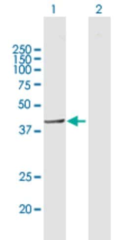 ELAC1, Mouse anti-Human, Polyclonal Antibody, Abnova 50&mu;g; Unconjugated:Antibodies,