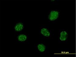 ELAC1, Mouse anti-Human, Polyclonal Antibody, Abnova 50&mu;g; Unconjugated:Antibodies,