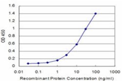 CDKN2AIP, Mouse anti-Human, Clone: 1E10, Abnova 100&mu;g; Unconjugated:Antibodies,