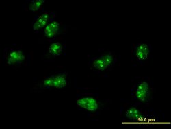 TASP1, Mouse anti-Human, Clone: 3E10, Abnova 100 &mu;g | Buy Online | Abnova | Fisher Scientific