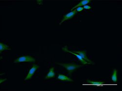 RIOK2, Rabbit anti-Human, Polyclonal Antibody, Abnova 100&mu;g; Unconjugated:Antibodies,