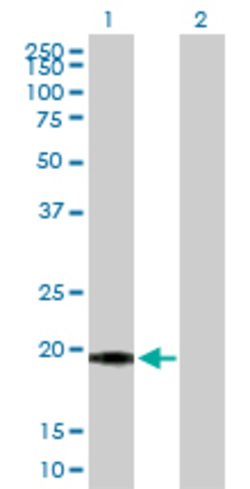 SELS, Rabbit anti-Human, Polyclonal Antibody, Abnova 100&mu;g; Unconjugated:Antibodies,
