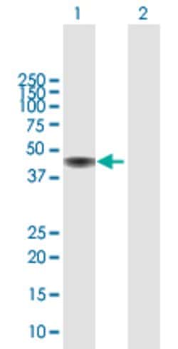 CENPJ, Rabbit anti-Human, Polyclonal Antibody, Abnova 100&mu;L; Unconjugated:Antibodies,